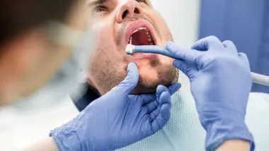 کشیدن دندان عقل برای این افراد ممنوع است