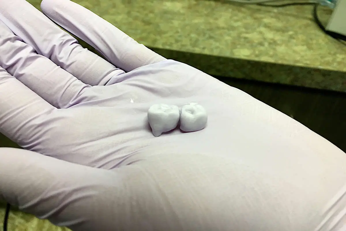 دندان مصنوعی با فناوری چاپ سه‌بعدی به کمک باکتری‌ها
