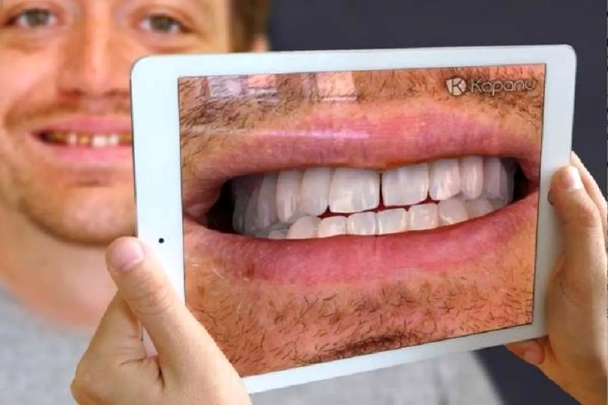 آینه مجازی لبخندتان را قبل از جراحی دندان نشان می‌دهد