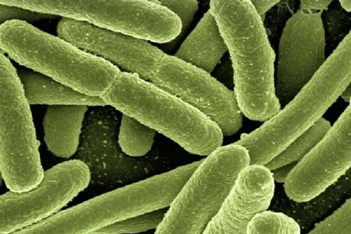 شناسایی سریع باکتری ها با میکروسکوپ هوش مصنوعی