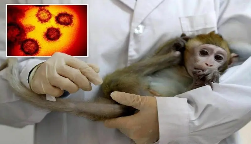 بیماری آبله میمون چیست؟ /  آیا این بیماری مسری است؟