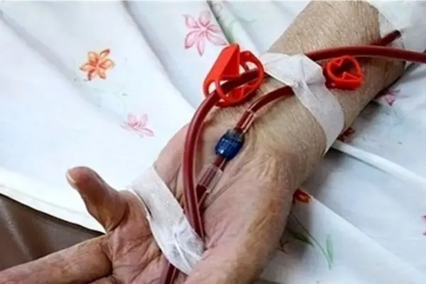 آخرین وضعیت بیماران پروانه‌ای در ایران تشریح شد