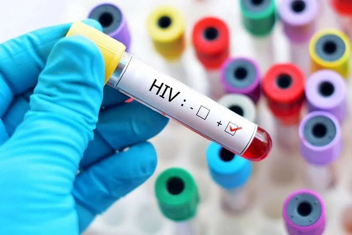 ۲۳ هزار مبتلای رسمی به HIV در کشور