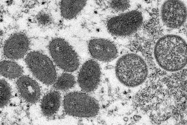 آنچه باید از ویروس کُشنده «نیپا» بدانیم/ آیا همه‌گیر می‌شود