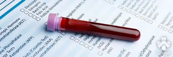 شناسایی ۳ نوع سرطان با یک قطره خون 