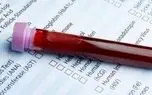 شناسایی 3 نوع سرطان با یک قطره خون 