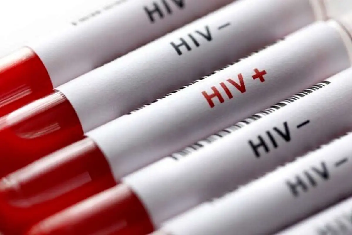 آخرین وضعیت HIV در کشور/ تغییر در الگوی راه انتقال و درصد ابتلای زنان و مردان