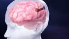 رقیب نورالینک رکورد ایمپلنت الکترود را در مغز شکست